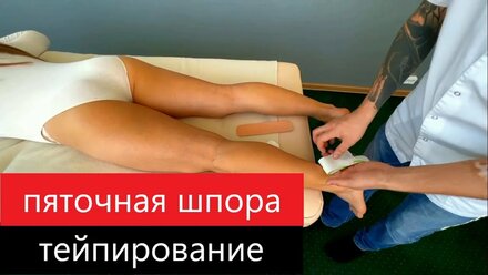 Пяточная шпора, тейпирование