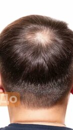 Пудра SEVICH для маскировки отросших корней и редких волос #hair #волосы #загуститель #sevich #лысый