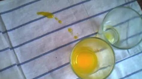 地下鉄 デジタルハリネズミ2