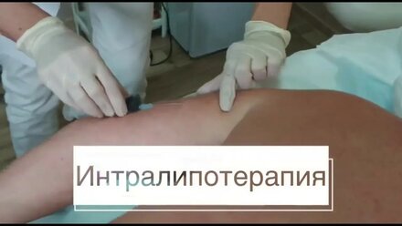 Интралипотерапия