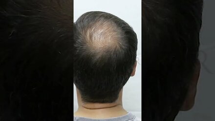 ЛУЧШЕЕ средство для скрытия седины #hair #sevich камуфляж редких волос SEVICH #shorts #пудра #пудра