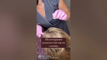 Мезотерапия головы с завершающим сосудистым этапом #облысение #мезотерапия #витамины #алопеция #
