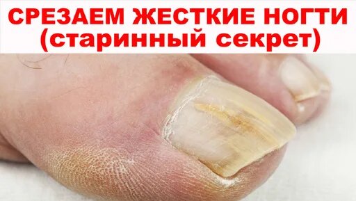 Оның кеуделерін әдемі шайқайды