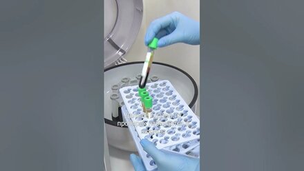 Как получают плазму из крови пациента и для чего это нужно