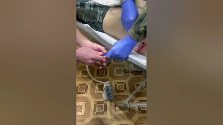 Открытый пневмоторакс