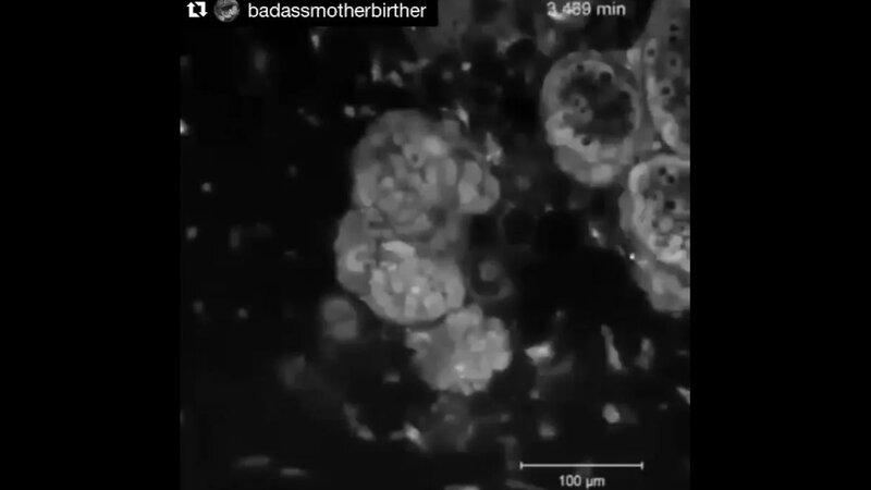 Memeye şevkat gönderme pratiğiyle emzirme olumlamaları - Yandex Video ...