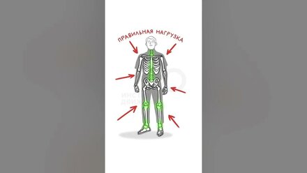 Наглядно: зачем нужны ортопедические стельки