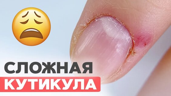 Чистый аппаратный маникюр при опасной кутикуле | Макро— Видео от Школа ногтевого искусства S…