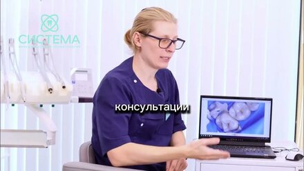 Кариес или пигмент в фиссурах зуба. Кейс лечения Зубов