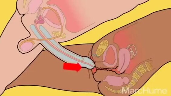 Jinsiy aloqa er xotini va uning sevgilisi fotosurati