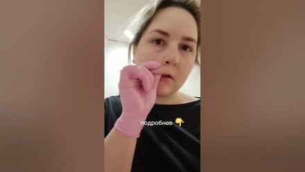 Как убрать кисетные морщины #массажлица #самомассаж инструкция ниже под видео