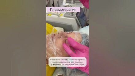 Плазмотерапия #косметология #косметолог #плазмотерапия #эстетикагрупп