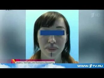 Уголовное дело завели на косметолога, от действий которой пострадали десятки москвичек