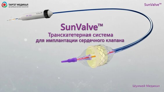 SunValve (Shunmei) баллонорасширяемый клапан TAVI - Смотреть онлайн в ...