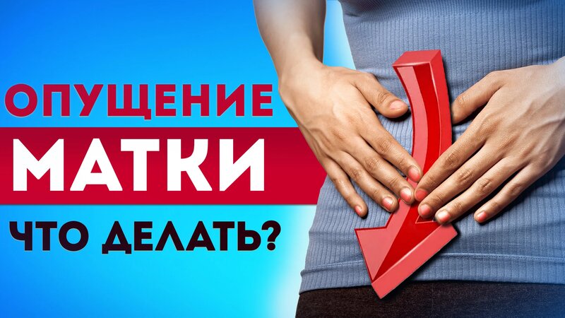 Опущение матки — от причин до методов лечения! / 5 основных упражнений ...