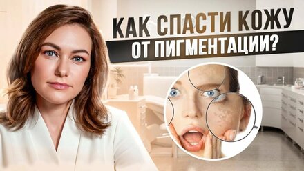 ПИГМЕНТАЦИЯ | СПАСИТЕ КОЖУ ОТ ПИГМЕНТАЦИИ | КАК ЛЕЧИТЬ ПИГМЕНТАЦИЮ? | NEW WAY CLINIC
