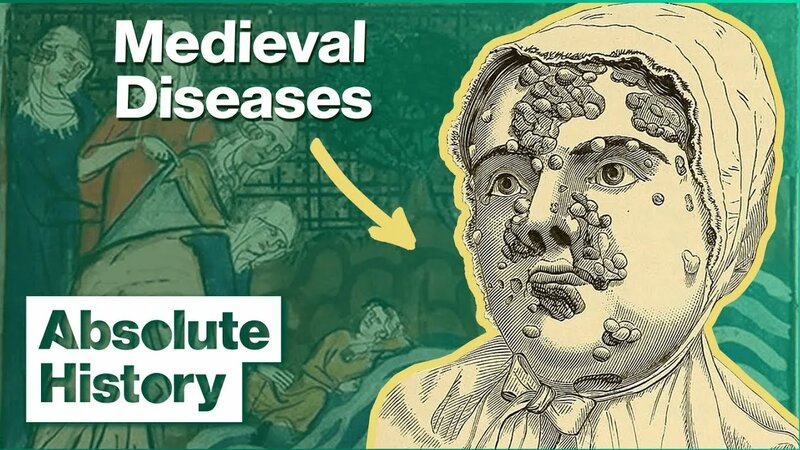 The Grim Realities Of Life Before Medicine | Medieval Dead | Absolute ...