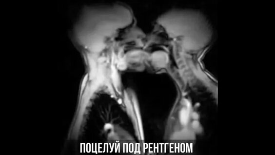 Үлкен сисьмо жапон порно онлайн