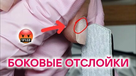 БОКОВЫЕ ОТСЛОЙКИ | Сделай так ☝️| Как вернуть сцепку на ногтях
