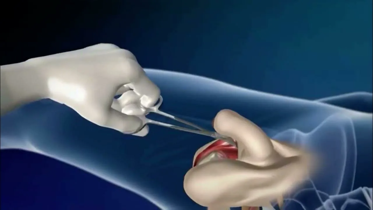Транс операциядан кейінгі онлайн