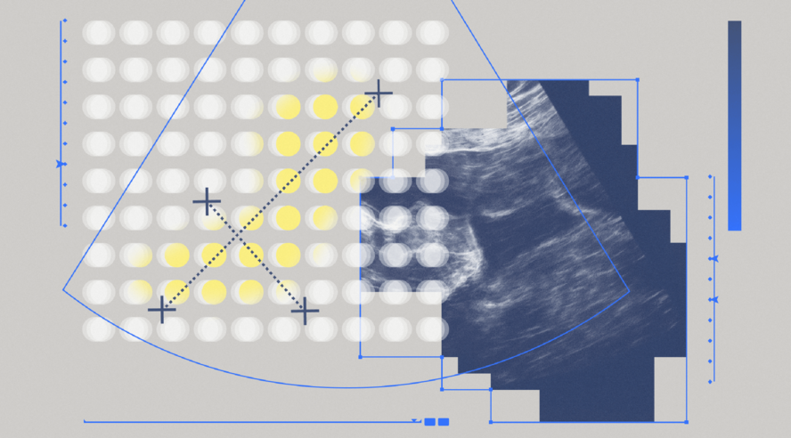 Новая нейросеть Яндекса, НМИЦ Кулакова и фонда «Спина бифида» поможет врачам выявлять редкую патологию на ранних сроках беременности