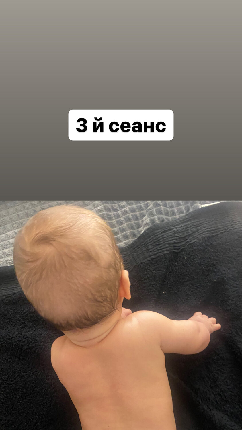 кривошея, ребенок, малыш, для детей, ребёнок в 3 месяца