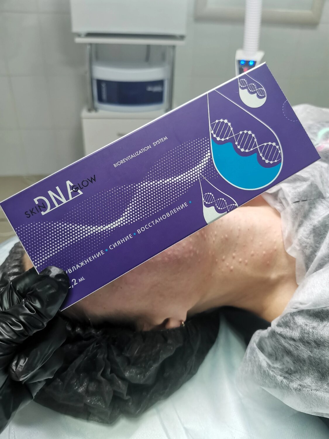 скинглоу биоревитализант, skin dna glow биоревитализация лица, биоревитализант, биоревитализация препарат, биоревитализант skin dna glow