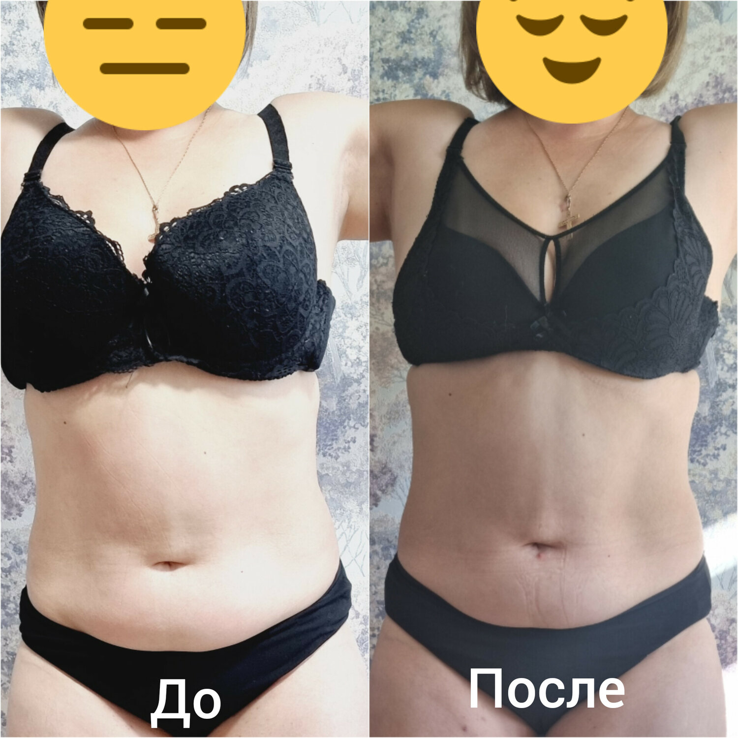 результат, девушка, после, тело