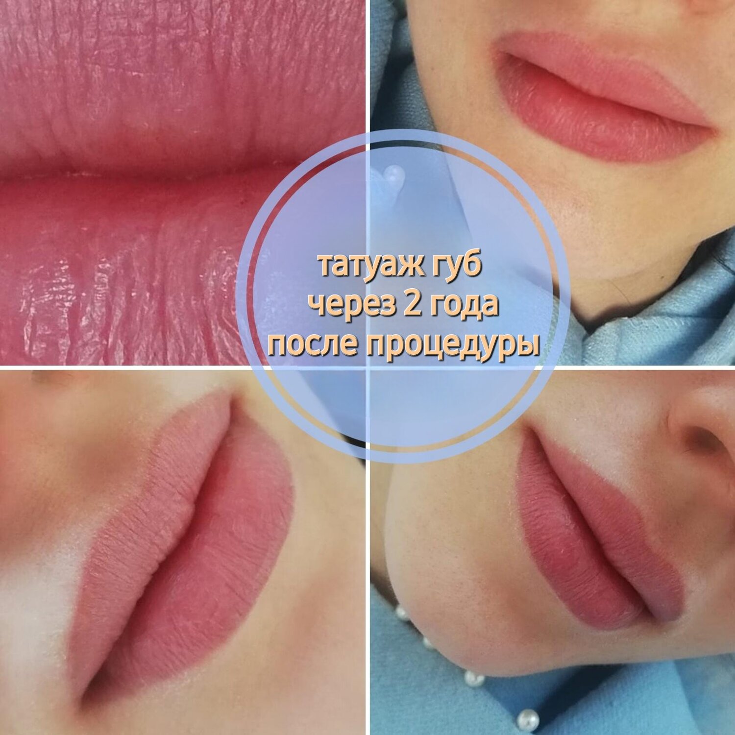 губы татуаж, перманентные губы, увеличение губ, губы перманентный макияж, губы ботокс