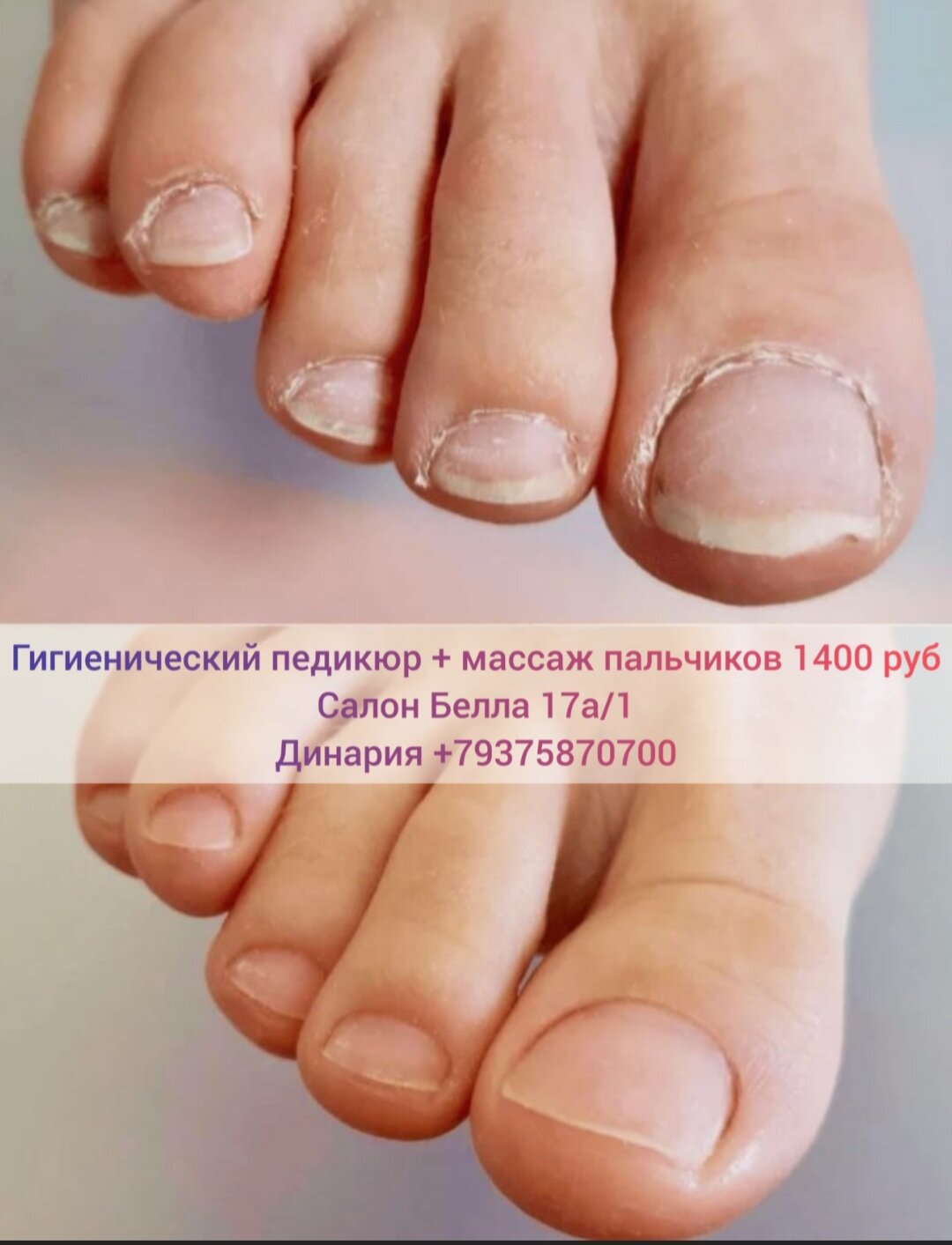 педикюр, гигиенический педикюр, подология медицинский педикюр, педикюр без покрытия, медицинский педикюр