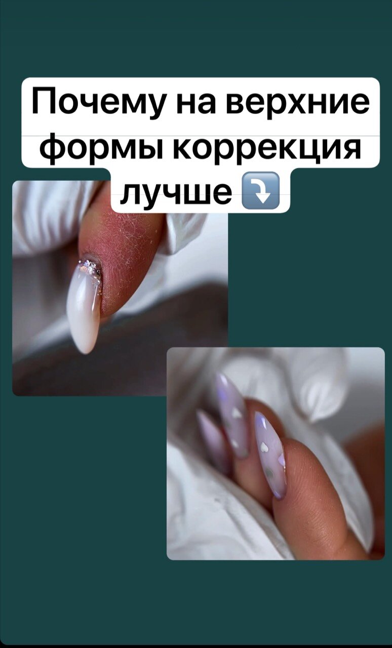наращивание верхними формами, коррекция нарощенных ногтей, этапы наращивания на верхние формы, ногти коррекция, наращивание ногтей на верхние формы