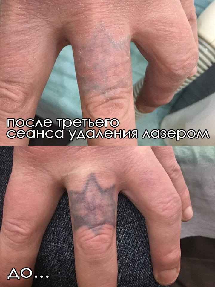 ���������������� �������������������� ��������������, ���������������� �������� ��������������, �������� ���������� ���������������� ��������������, ���������������� ���������������� ��������������������, ���������������� ���������������� ��������