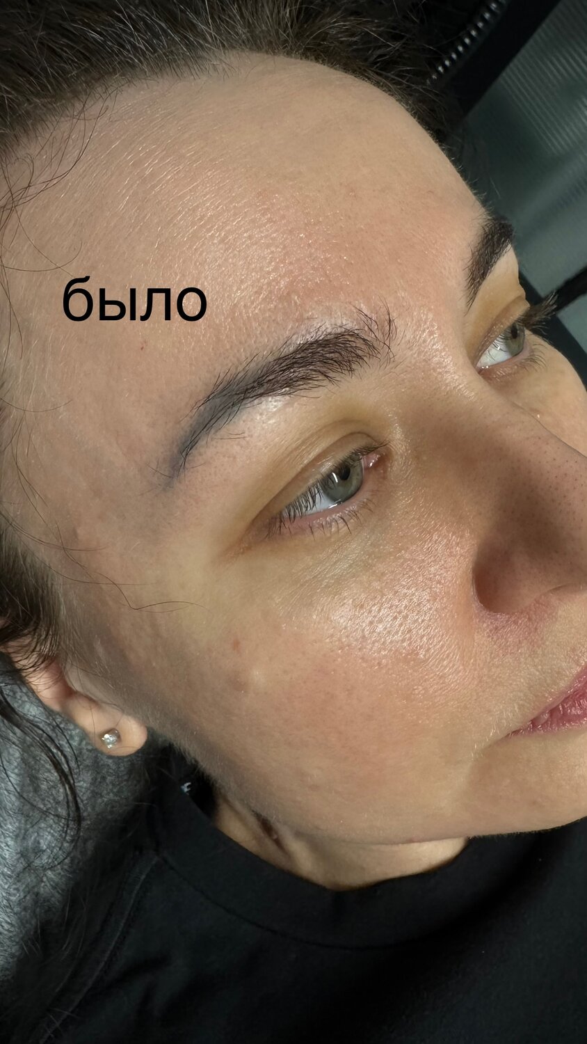 инъекции коллагена для лица до и после, лифтинг лица, пилинг лица, брови окрашивание, окрашивание бровей хной