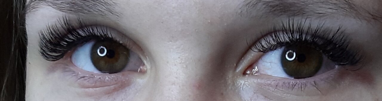 глаз, редкие ресницы, ресницы, гипотрихоз ресниц, люди