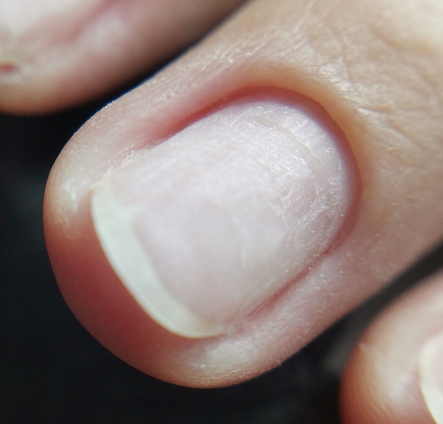 маникюры, ногти, nail, белая часть ногтя, manicure