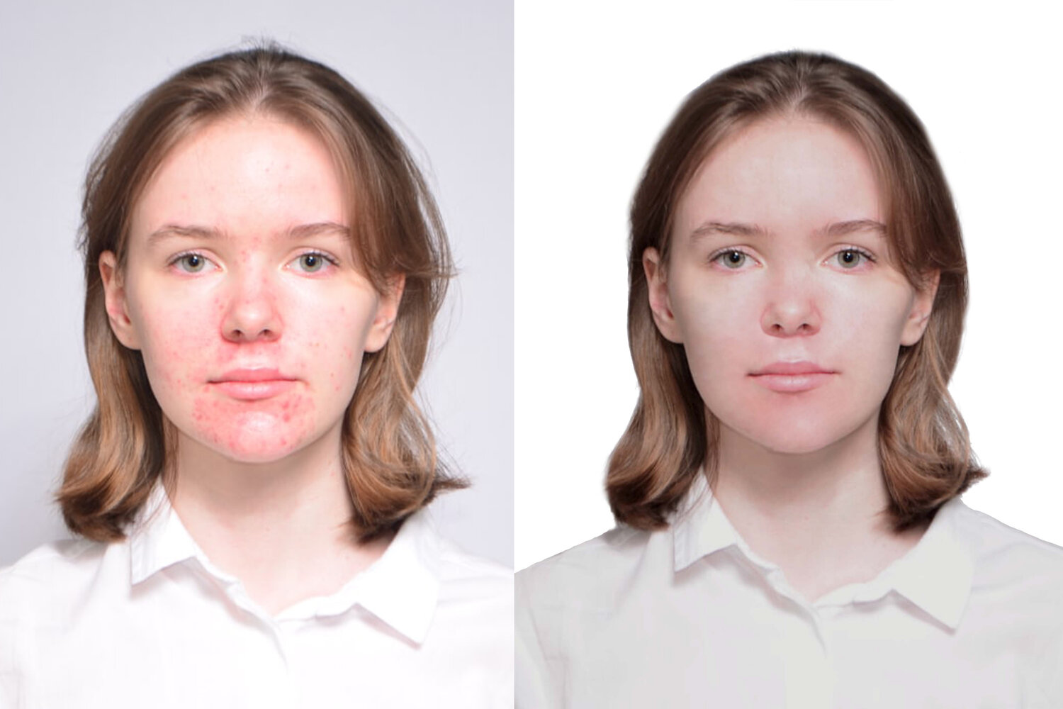 часть лица, фронтопластика лица, лицо, человек, ершова мария анатольевна