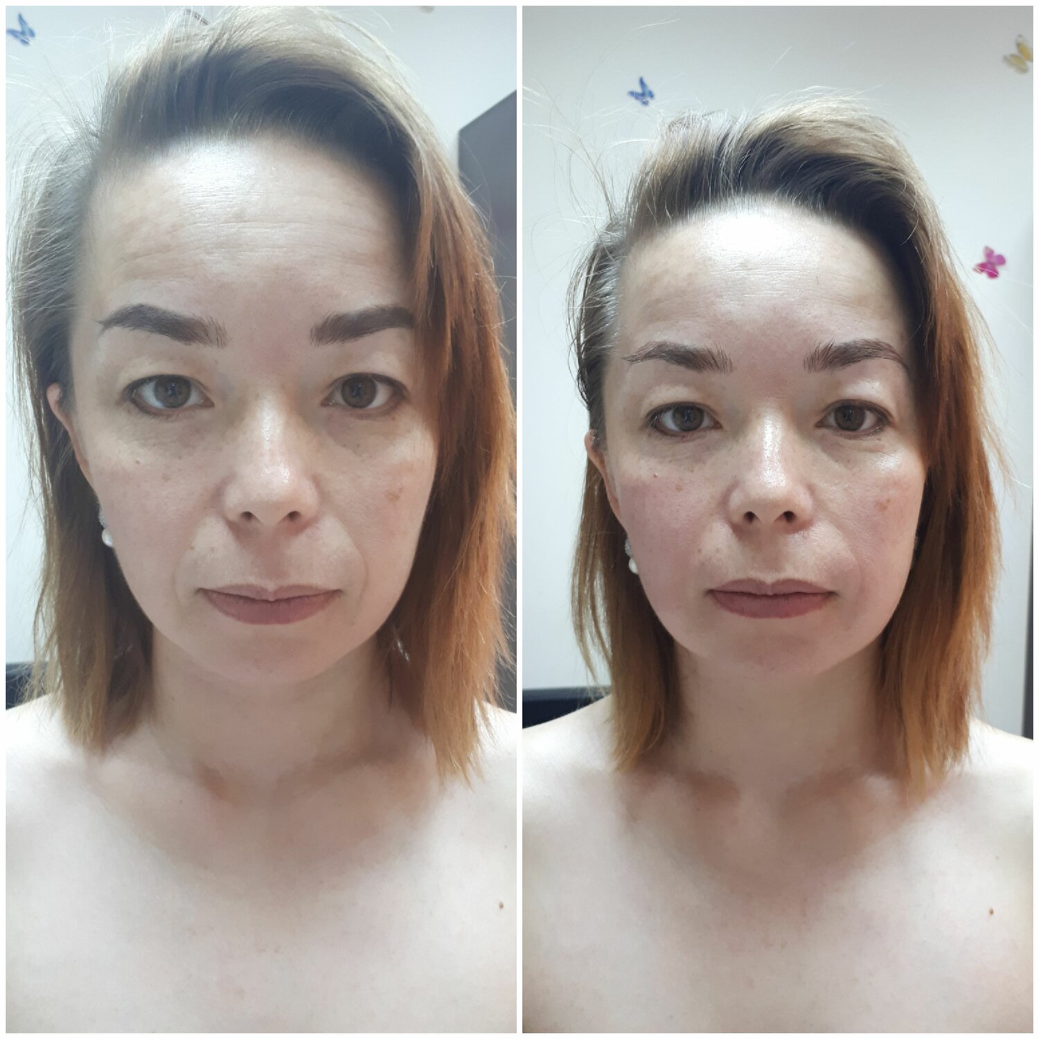 лица, часть лица, макияж, процедура, омоложение