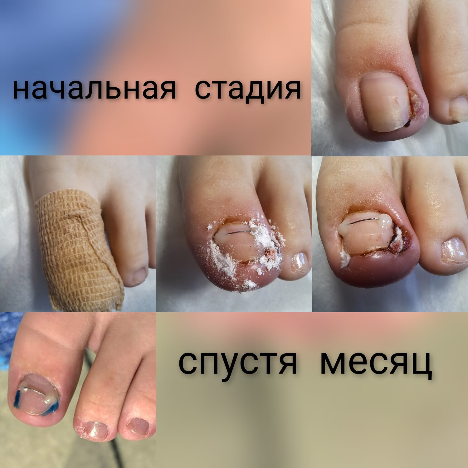 ���������������� ������������, �������������� �������������� ������������, ���������������������� ��������������, �������������� ������������ ������������, �������������� ������������ ���� ����������