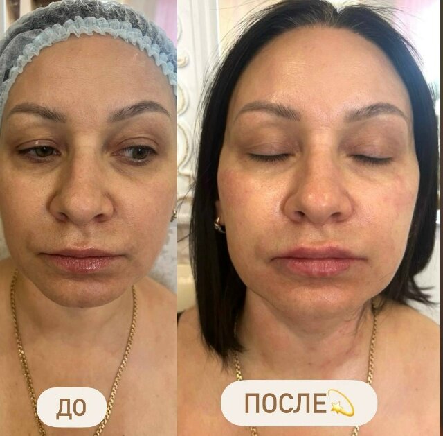 �������������� ��������, ���������������� ��������, ������������������ ������ ��������, �������������� ������������, �������� �������������� ��������