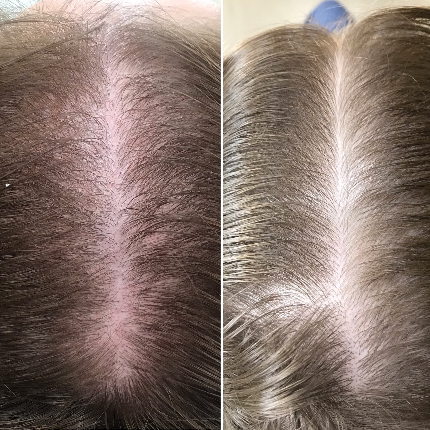 волос, волоски, hair, перхоть, био волокно волосы