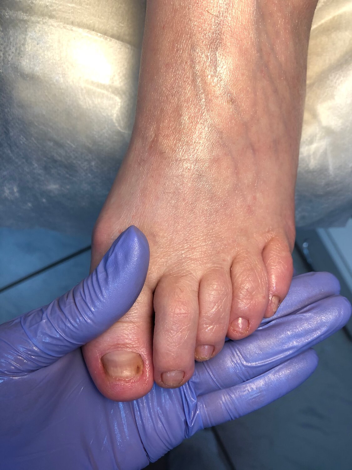 педикюр, педикюр для пожилого человека, ногти, human foot, маникюр и педикюр