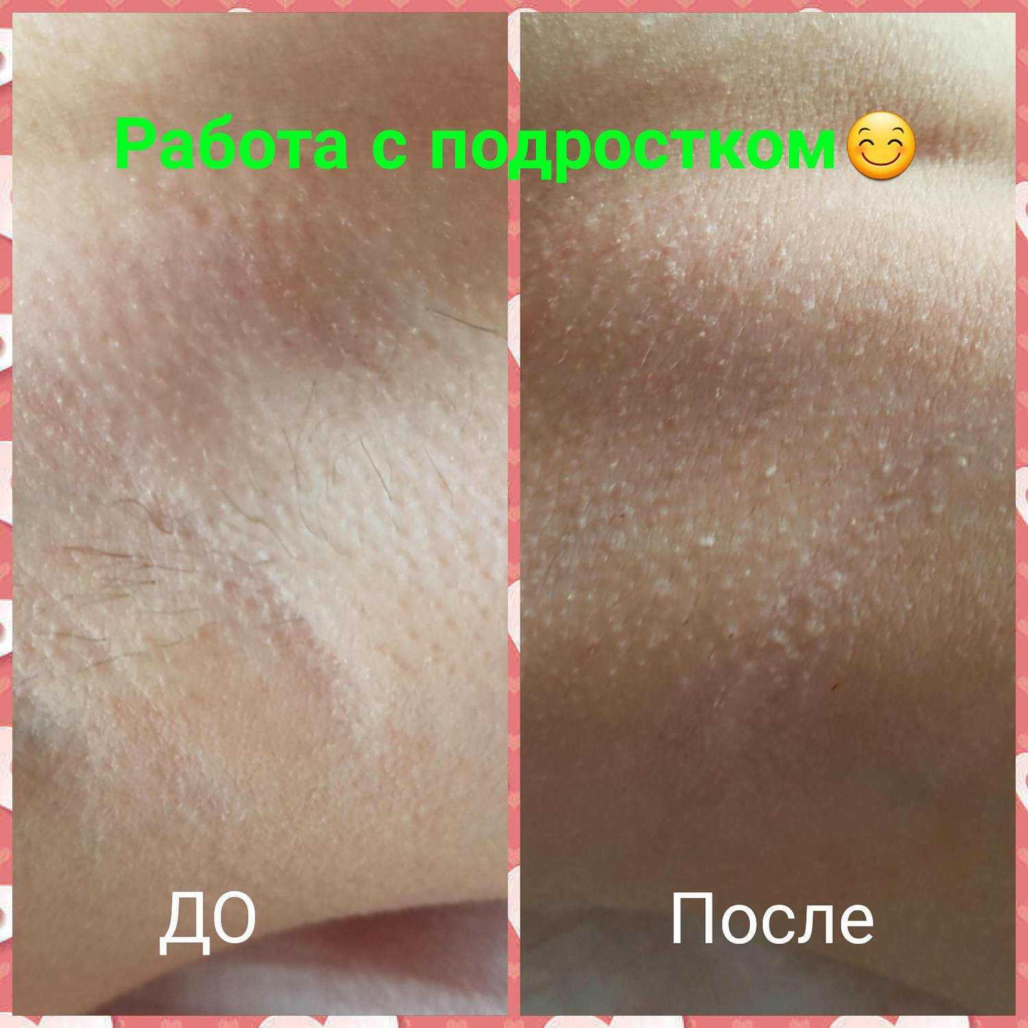 крем для лица, пилинг, шугаринг, паста для шугаринга elba cosmetics средняя, пилинг слово
