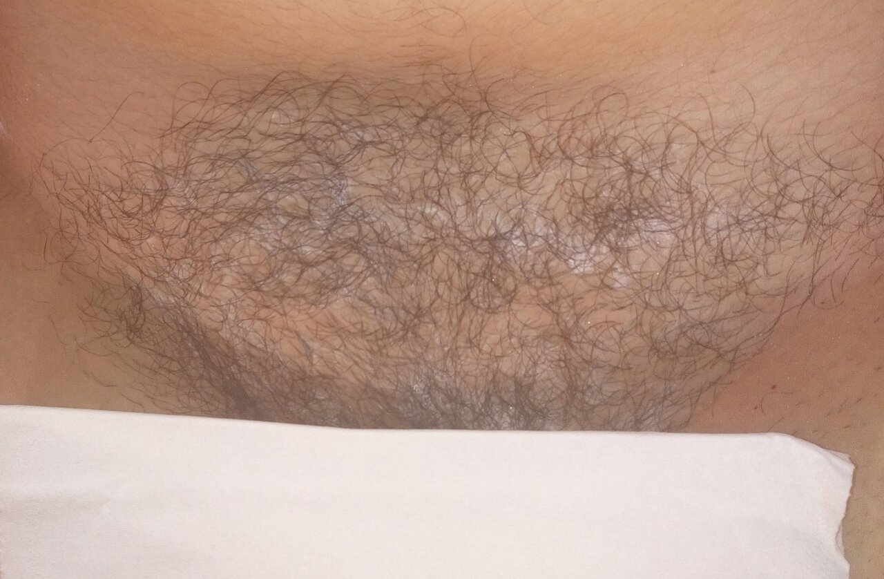 Депиляция сахаром (шугаринг): глубокое бикини в Голубицком сельском поселен...