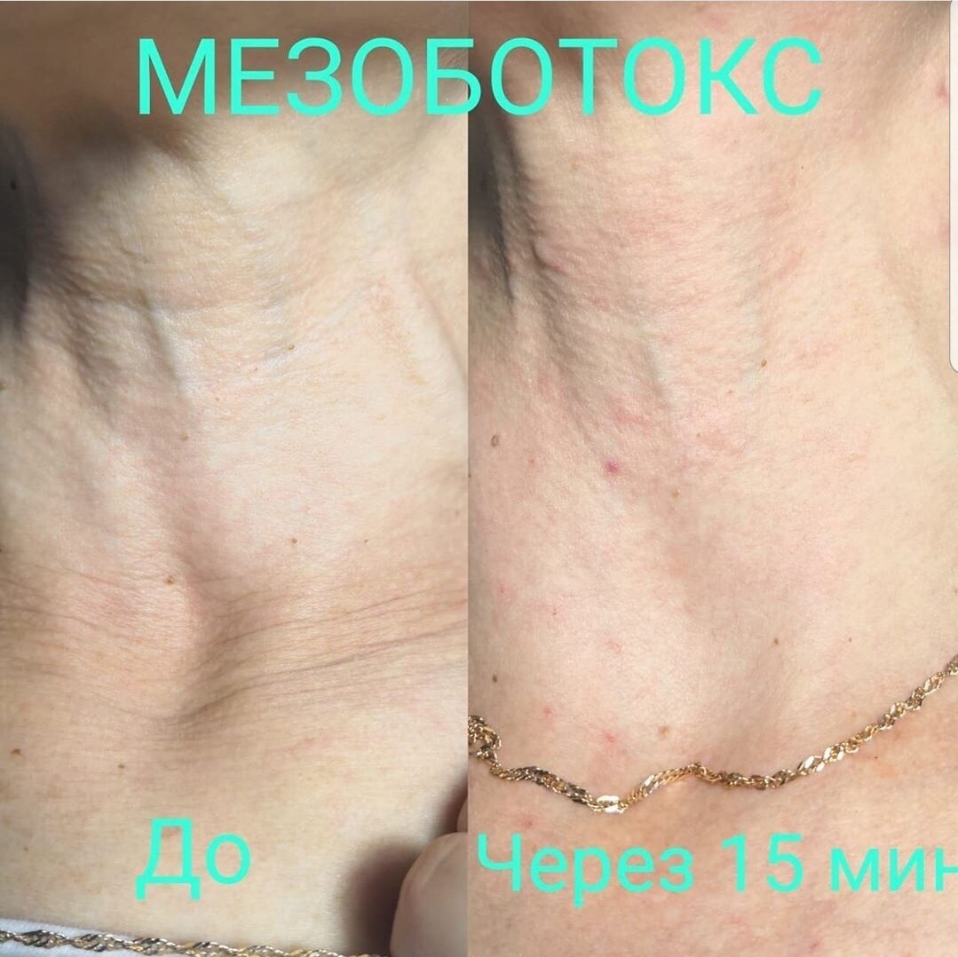 часть тела человека, шей, мезо, шугаринг для мужчин до и после, запястье