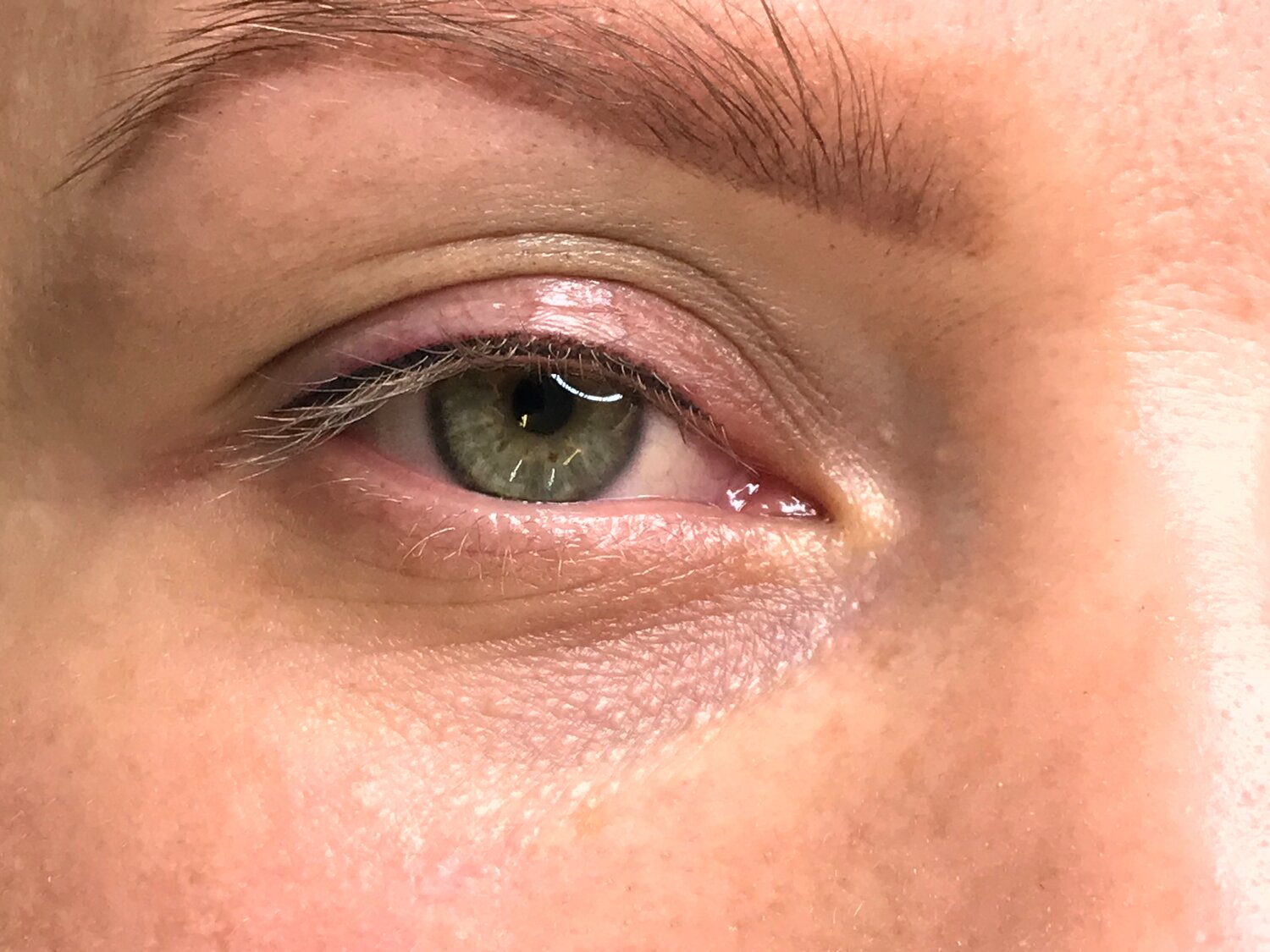 глаз, часть лица, глаз человека, круги под глазами, brown eye