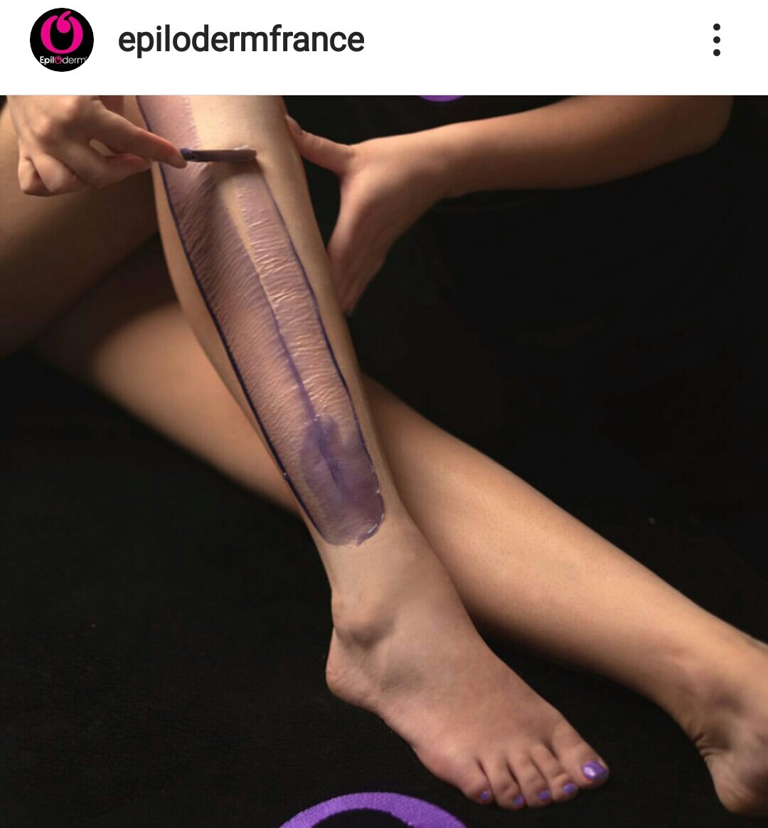 нога, ног, leg, эпилодерм, ступня