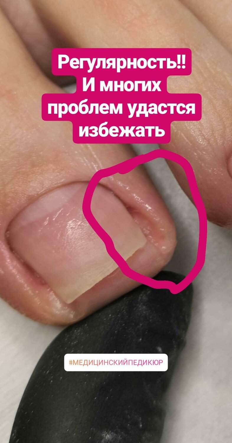 ногти, nail, кутикула, боль в языке, рука