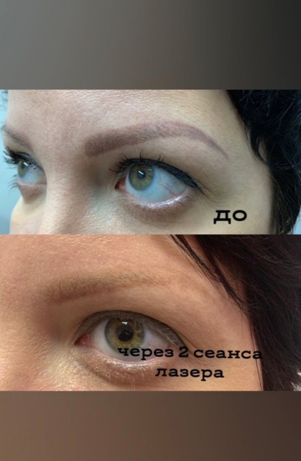 ресницы до и после сыворотки, ресницы, рост ресниц по неделям, масло бэй для ресниц и бровей, ламинирование и ботокс бровей прайг