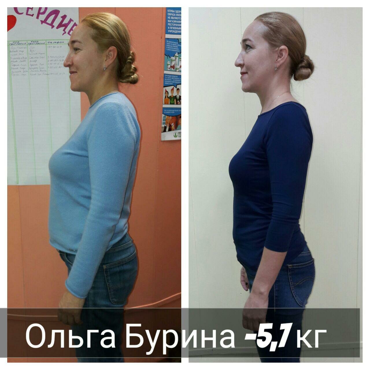сколиоз сутулость, сутулость после родов, плохая осанка, осанка, трикотаж