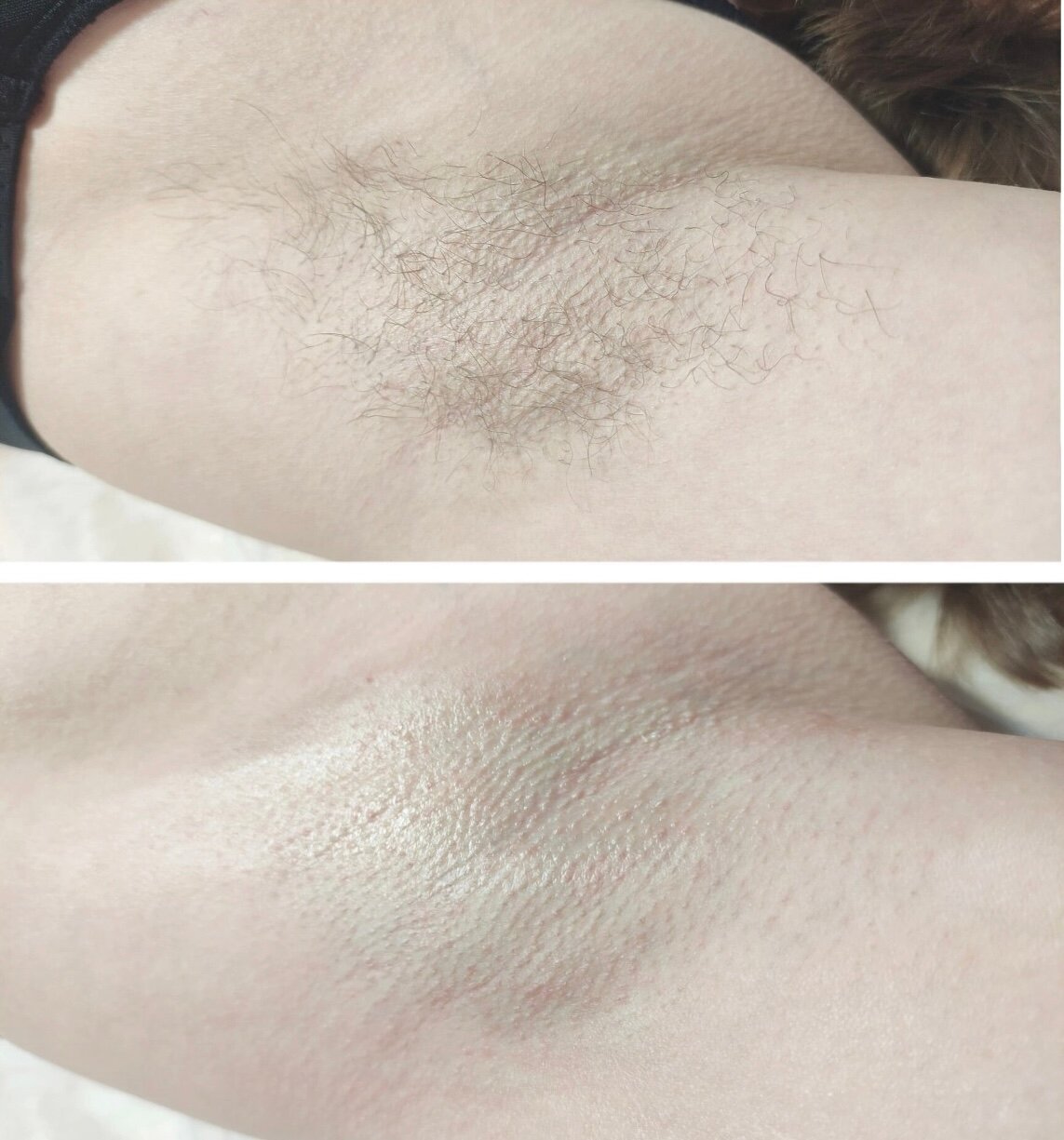 депиляция, восковая депиляция, эпиляция, лазерная эпиляция, шугаринг